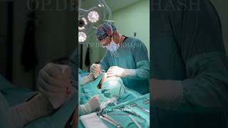 Rhinoplasty results turkey beforeandafter plasticsurgery istanbul shorts plasticsurgeon [upl. by Mloclam]