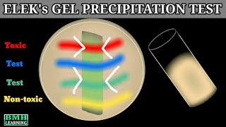 Eleks Gel Precipitation Test  Elek Test  Corynebacterium Diptheriae Gel Precipitation Test [upl. by Oeht700]