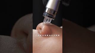 quotfatiguequot caused by overtime work Immersive skin care Deep pore cleaning Large pores asmr [upl. by Eytak988]