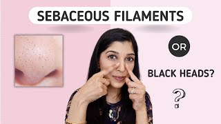 Black Dots On The Nose How To Treat Sebaceous Filaments  Dr Swati Kannan [upl. by Imij]