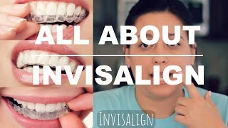 INVISALIGN REVIEW  HOW IT WORKS AND WHAT TO EXPECT [upl. by Bevus]