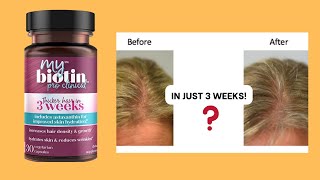 My Biotin Pro Clinical Dont Buy Until You Know This [upl. by Kcirddot]