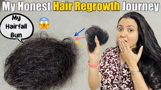 My Hair Loss amp Hair Regrowth Journey  Sharing My Story❤️ [upl. by Saphra]