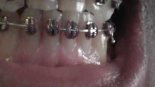 Week 43 in braces [upl. by Hubert]