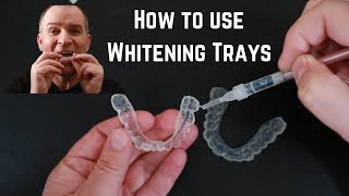 How to use custom fit tooth whitening trays [upl. by Iraj161]