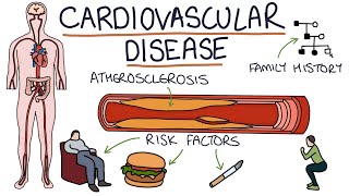 Understanding Cardiovascular Disease Visual Explanation for Students [upl. by Einor943]