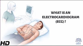 What Is An Electrocardiogram [upl. by Sessilu]