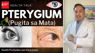 Pterygium Pugita sa Mata Causes Symptoms Complications Treatment amp Prevention [upl. by Dodi]