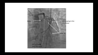 Coronary angiographic views Elias Hanna [upl. by Elvira658]