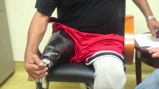 Amputee dons Stan Patterson NPS Elevated Vacuum Above Knee Socket Tutorial [upl. by Assiren]