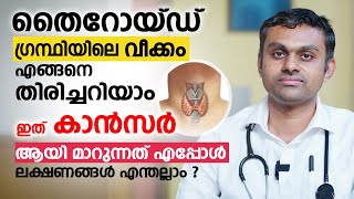 തൈറോയ്ഡ് ഗ്രന്ഥി വീക്കം എങ്ങനെ തിരിച്ചറിയാം  ഇത് കാൻസർ ആയി മാറുന്നത് എപ്പോൾ  Thyroid Goiter [upl. by Oicinoid]