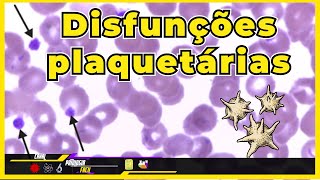 Plaquetas  Doenças Relacionadas as Disfunções Plaquetárias com exames Atualizado 2024 [upl. by Madaih635]