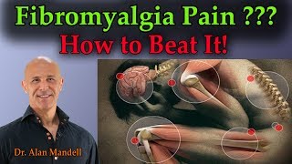 Fibromyalgia Pain How To Beat It  Dr Mandell [upl. by Urdna]