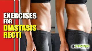 21Day Diastasis Recti Workout Challenge  Post Pregnancy Ab Challenge [upl. by Rehpotsrihc510]