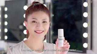 Eucerin Pro ACNE Solution Day Mat Whitening【4周内减少痘疤 • Reduce Acne Marks in 4 Weeks】 [upl. by Atews]