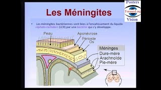 Méningite bactérienne cérébro spinale maladie infectieuse [upl. by Levi]