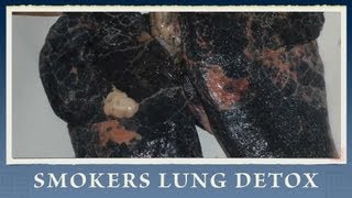 7 Steps on How to Heal and Recover Lungs from Smoking [upl. by Luigi]