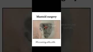 Mastoid surgery procedureanatomy reels hearttouching study youtube ytshorts ytviral [upl. by Philbo]