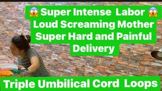 SUPER INTENSE LABOR  VERY HARD And PAINFUL DELIVERY  TRIPLE NUCHAL CORD  2nd BABY  REPOSTED [upl. by Fesoy530]