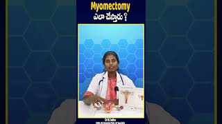 Myomectomy ఎలా చేస్తారు  doctor tanuku telugu information ytshorts youtubeshorts [upl. by Waddington]