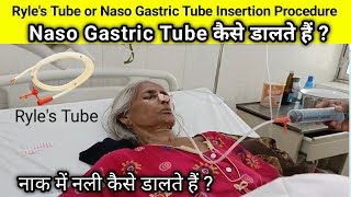 Ryles Tube or Naso gastric Tube insertion procedure Ryles Tube कैसे डालते हैं nasogastric Tube कैसे [upl. by Wagshul]