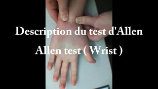 Description du test dAllen [upl. by Amehr830]