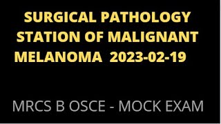 SURGICAL PATHOLOGY STATION OF MALIGNANT MELANOMA [upl. by Bevash422]