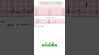 Understanding Prolonged QT Interval Causes Medications amp Prevention [upl. by Orv537]