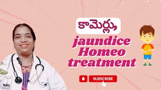 కామెర్లు jaundiceHomeo treatment SudharamanHomeoClinic [upl. by Aicssej]