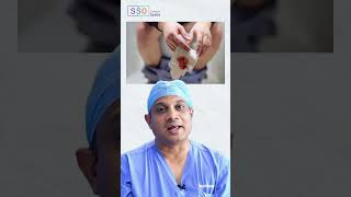 Warning Signs of Rectal Cancer You Shouldnt Ignore  Dr Nilesh Chordiya SSO [upl. by Lokim564]