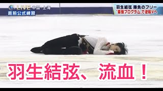 羽生結弦、流血！ 中国選手との衝突の瞬間！！ [upl. by Lilybelle]