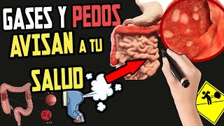 PELIGRO GASES PEDOS y DOLOR de ABDOMEN  Como ELIMINARLOS Rápidamente [upl. by Oisinoid297]