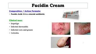 Best Antifungal drug  Common Skin cream and Ointments [upl. by Tini]