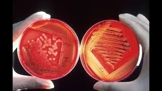 Agar A Versatile Tool in Microbiology 5 Minutes Microlearning [upl. by Oicnaneb]