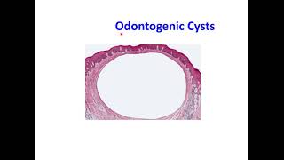 Odontogenic Cysts [upl. by Schilit]