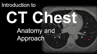 Introduction to CT Chest  Anatomy and Approach [upl. by Bara]