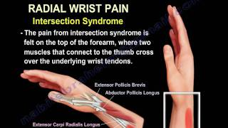 Wrist Paincauses and treatmentPart 2  Everything You Need To Know  Dr Nabil Ebraheim [upl. by Rosenberg]