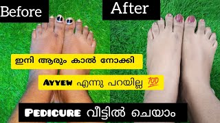 ഇരുണ്ട കാലുകൾ നിറം വെയ്ക്കാൻ  Pedicure at Home  Malayalam [upl. by Roee]