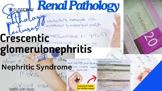 crescentic glomerulonephritis  renal pathology  nephritic syndrome  Drsamcrest [upl. by Emanuela]