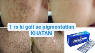 1 rs mein pigmentation GAAYAB [upl. by Kunz]