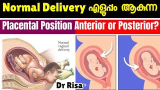 പ്രസവം എളുപ്പമാകുന്ന Placental Position  Anterior amp Posterior Placenta [upl. by Sivrat]