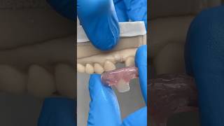 Lateral Nesbit EnvisiontecMain envisiontec dental teeth smile lsk121shorts shortvideo [upl. by Cacilie846]