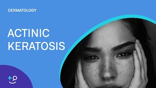 Actinic Keratosis Dermatology [upl. by Herby709]