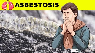 Asbestosis  Causes Pathogenesis Signs amp Symptoms Diagnosis And Treatment [upl. by Imuyam]