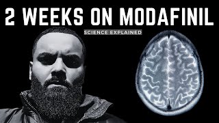 MODAFINIL EXPLAINED  2 WEEK EXPERIENCE UPDATE [upl. by Haidebez]