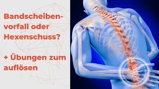 Bandscheibenvorfall oder Hexenschuss  was habe ich und wie werde ich es los  Übung für zu Hause [upl. by Sefton]