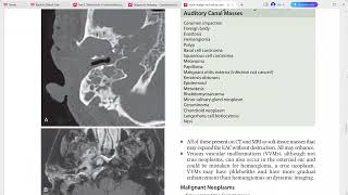 NEURORADIOLOGY CORE REQUISITES [upl. by Llevra236]