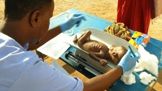 Malnutrition at record high in droughthit Somalia ICRC [upl. by Dnanidref103]