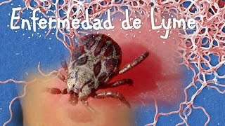 Enfermedad de Lyme Borrelia [upl. by Assej]