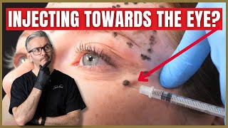 Can you inject Botox towards the eye Botox Needle Placement amp Injection Techniques [upl. by Nasya]